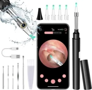 Zupora Ear Camera Ear Wax Removal Kit: A Safe and Effective Way to Clean Your Ears